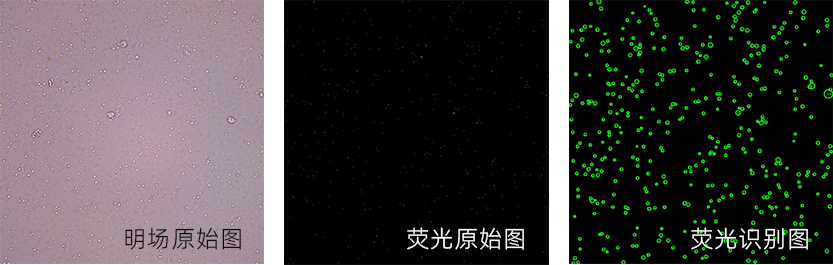 圖像法自動化的血小板計數(shù)