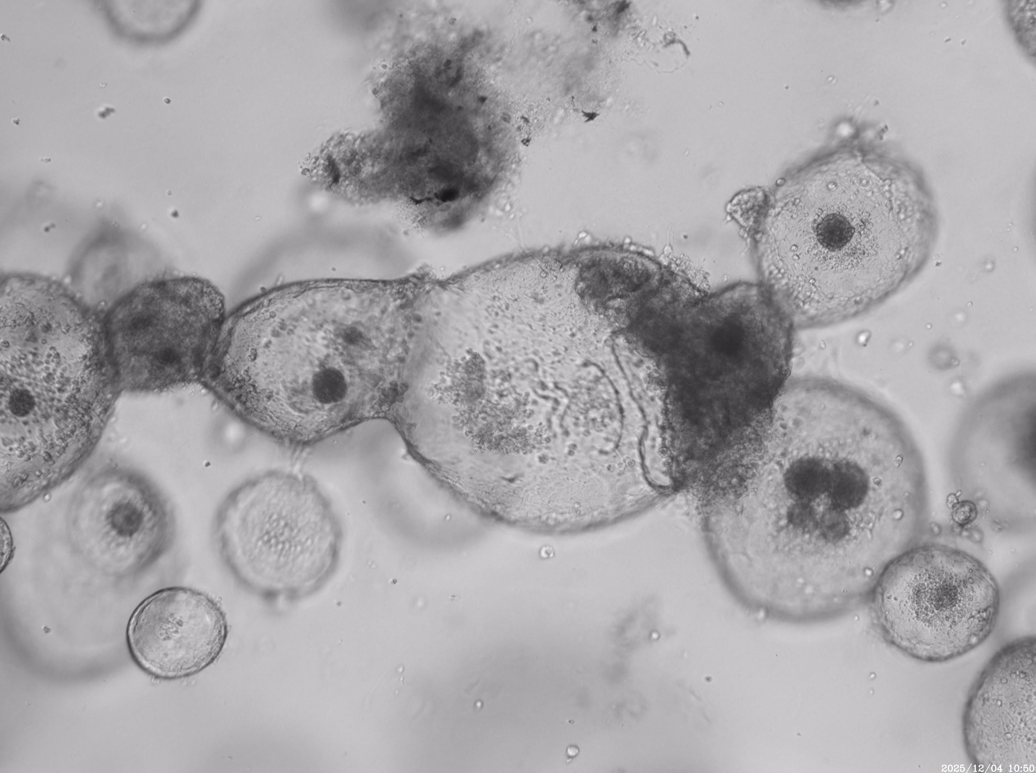 案例分享：小鼠子宮內膜類器官長時程生長監測